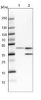 Beta-1,4-Galactosyltransferase 3 antibody, NBP1-88653, Novus Biologicals, Western Blot image 