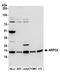 Actin Related Protein 2/3 Complex Subunit 4 antibody, A305-398A, Bethyl Labs, Western Blot image 