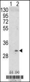 Integral Membrane Protein 2A antibody, 62-450, ProSci, Western Blot image 
