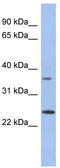 Postacrosomal sheath WW domain-binding protein antibody, TA338888, Origene, Western Blot image 