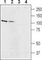 Solute Carrier Family 9 Member A5 antibody, PA5-77561, Invitrogen Antibodies, Western Blot image 