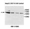 Zinc finger protein with KRAB and SCAN domains 4 antibody, orb77933, Biorbyt, Western Blot image 