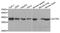 Actin Related Protein 2 antibody, TA332871, Origene, Western Blot image 