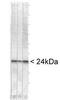 Ubiquitin C-Terminal Hydrolase L1 antibody, TA336530, Origene, Western Blot image 