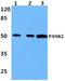 Pantothenate kinase 2, mitochondrial antibody, A02776-1, Boster Biological Technology, Western Blot image 