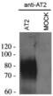 AGTR2 antibody, PA3-210, Invitrogen Antibodies, Western Blot image 