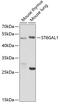 ST6 Beta-Galactoside Alpha-2,6-Sialyltransferase 1 antibody, 19-836, ProSci, Western Blot image 