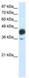 JunB Proto-Oncogene, AP-1 Transcription Factor Subunit antibody, TA335845, Origene, Western Blot image 