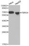 Protein TBRG4 antibody, abx000661, Abbexa, Western Blot image 