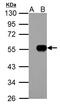 Inositol Hexakisphosphate Kinase 1 antibody, TA308137, Origene, Western Blot image 