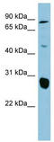 Solute Carrier Family 26 Member 4 antibody, TA346192, Origene, Western Blot image 