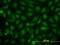 Cell cycle and apoptosis regulator protein 2 antibody, H00057805-M04, Novus Biologicals, Immunocytochemistry image 