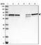 Sorting Nexin 2 antibody, NBP1-89485, Novus Biologicals, Western Blot image 