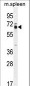 Leiomodin 2 antibody, LS-C165813, Lifespan Biosciences, Western Blot image 