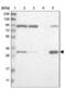 Electron Transfer Flavoprotein Subunit Alpha antibody, NBP1-84855, Novus Biologicals, Western Blot image 
