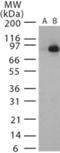 Lethal factor antibody, NB100-56666, Novus Biologicals, Western Blot image 