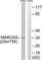 Myristoylated Alanine Rich Protein Kinase C Substrate antibody, TA314170, Origene, Western Blot image 