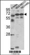 Fascin Actin-Bundling Protein 3 antibody, MBS9202147, MyBioSource, Western Blot image 