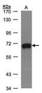 Polypeptide N-Acetylgalactosaminyltransferase 2 antibody, PA5-21541, Invitrogen Antibodies, Western Blot image 