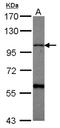Chondroitin Sulfate Synthase 1 antibody, NBP2-15899, Novus Biologicals, Western Blot image 