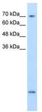 Solute Carrier Family 6 Member 8 antibody, TA346412, Origene, Western Blot image 