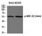 Myocyte Enhancer Factor 2D antibody, P01799, Boster Biological Technology, Western Blot image 