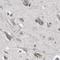 Acetyl-CoA Acyltransferase 2 antibody, NBP1-86128, Novus Biologicals, Immunohistochemistry paraffin image 