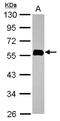 Ras association domain-containing protein 5 antibody, NBP2-19565, Novus Biologicals, Western Blot image 