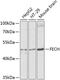 Ferrochelatase, mitochondrial antibody, 23-569, ProSci, Western Blot image 