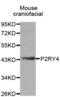 P2Y purinoceptor 4 antibody, abx002206, Abbexa, Western Blot image 