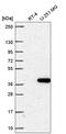 Zinc Finger Protein 713 antibody, HPA062887, Atlas Antibodies, Western Blot image 
