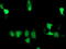 Suppressor Of Cytokine Signaling 3 antibody, TA503025, Origene, Immunofluorescence image 