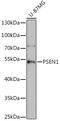 Presenilin 1 antibody, GTX55757, GeneTex, Western Blot image 