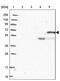 Copine-2 antibody, PA5-59440, Invitrogen Antibodies, Western Blot image 