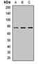 UTP4 Small Subunit Processome Component antibody, orb412800, Biorbyt, Western Blot image 
