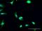 Chromosome 8 Open Reading Frame 33 antibody, H00065265-D01P, Novus Biologicals, Immunocytochemistry image 