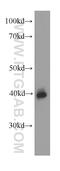 Alpha-2-Glycoprotein 1, Zinc-Binding antibody, 66178-1-Ig, Proteintech Group, Western Blot image 