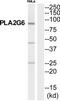 Phospholipase A2 Group VI antibody, TA314745, Origene, Western Blot image 