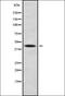 Cholinergic Receptor Nicotinic Gamma Subunit antibody, orb337940, Biorbyt, Western Blot image 