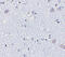 BR Serine/Threonine Kinase 1 antibody, 4083, ProSci, Immunohistochemistry frozen image 