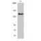 c-met antibody, LS-C380781, Lifespan Biosciences, Western Blot image 