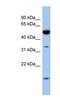 Retinol Dehydrogenase 12 antibody, NBP1-58017, Novus Biologicals, Western Blot image 