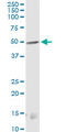 Cannabinoid Receptor 1 antibody, LS-C196941, Lifespan Biosciences, Western Blot image 