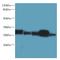 Haloacid Dehalogenase Like Hydrolase Domain Containing 3 antibody, A59354-100, Epigentek, Western Blot image 