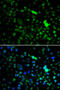 NOP2/Sun RNA Methyltransferase 6 antibody, MBS9127108, MyBioSource, Immunofluorescence image 