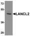 LanC Like 2 antibody, A07373, Boster Biological Technology, Western Blot image 
