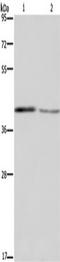 DES1 antibody, TA349884, Origene, Western Blot image 