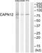 Calpain 12 antibody, abx014291, Abbexa, Western Blot image 
