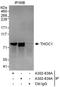 p84N5 antibody, A302-838A, Bethyl Labs, Immunoprecipitation image 