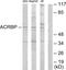 Acrosin Binding Protein antibody, GTX87784, GeneTex, Western Blot image 